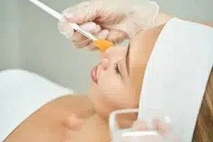 How Do Chemical Peels Help Your Skin?