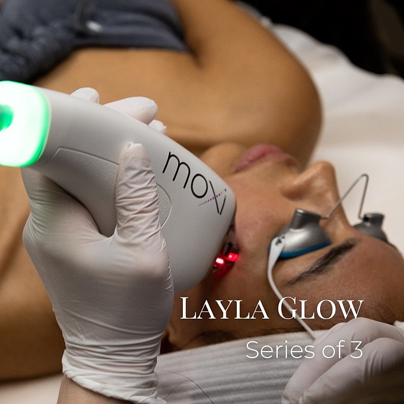 Moxie treatment session for skin rejuvenation.