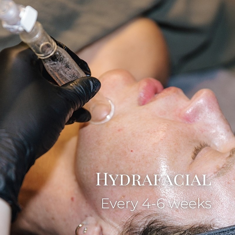 HydraFacial treatment in progress on client’s face.