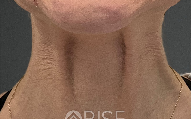 Medical Grade Skincare Before & After