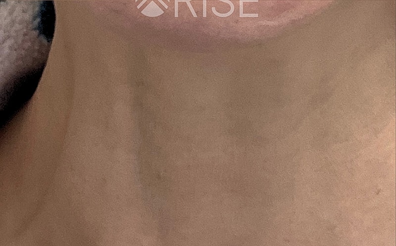 Medical Grade Skincare Before & After